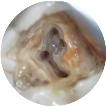 Endodontics - The Latest Irrigation, Instrumentation & Obturation Techniques